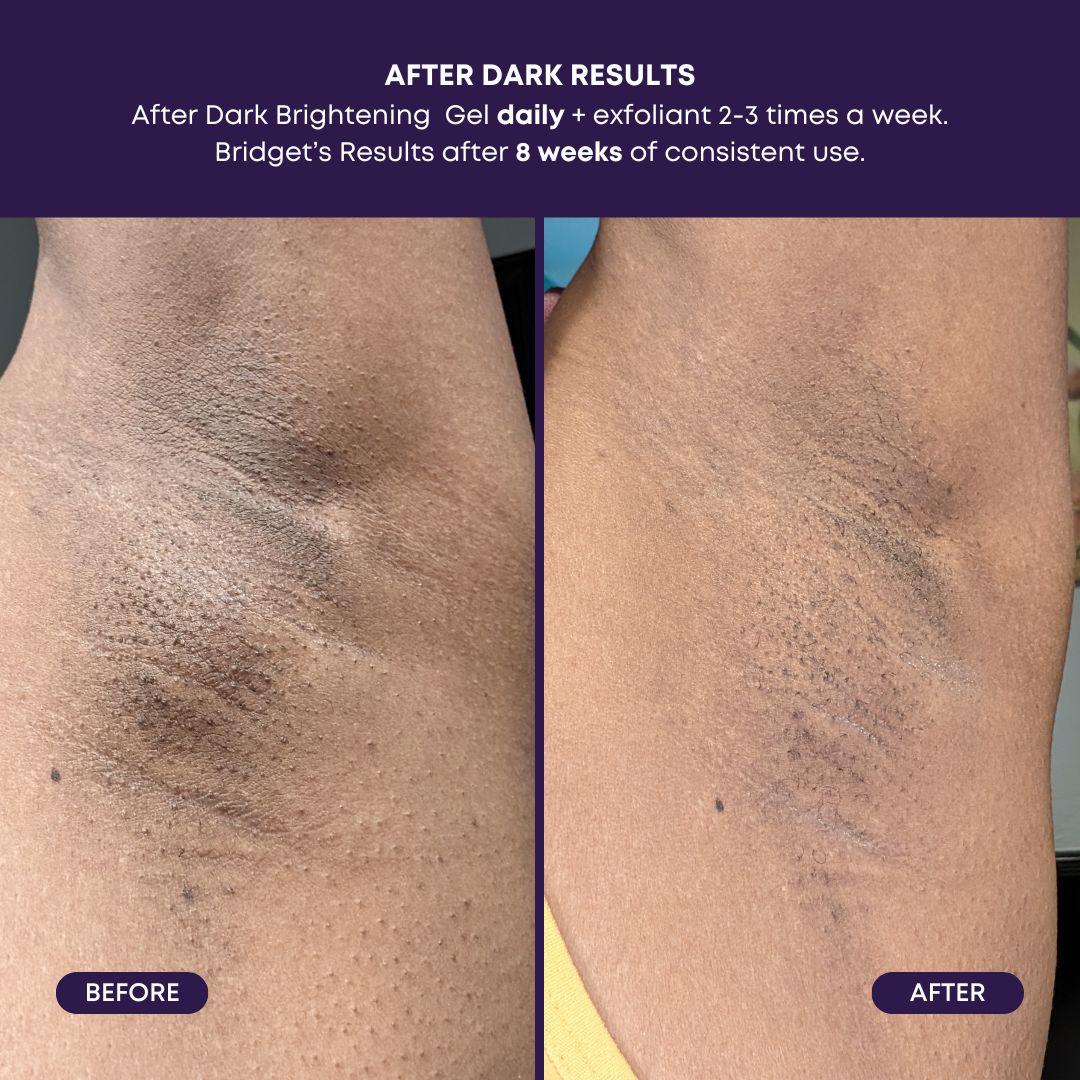 Bush Balm • After Dark Brightening Gel
